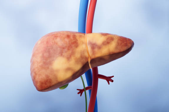 Liver Disorders