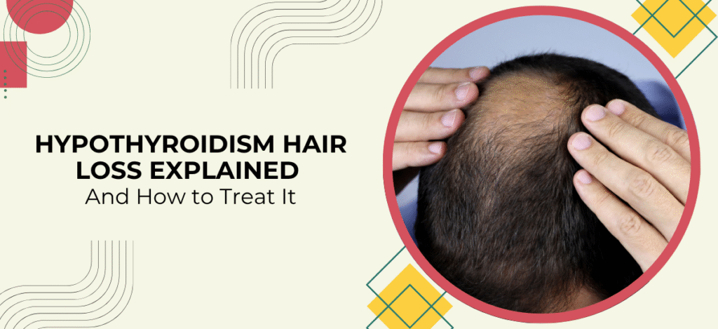Hypothyroidism Hair Loss