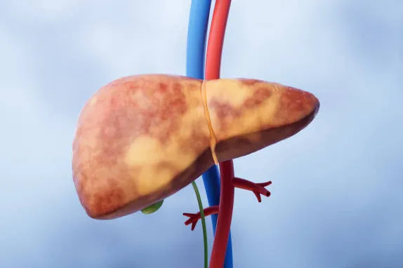 3D model of a human liver with attached blue and red blood vessels against a light blue background, for anatomical education.