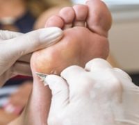 Podiatry Care